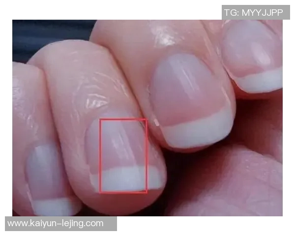 足球运动中的指甲伤害及其预防措施分析与建议